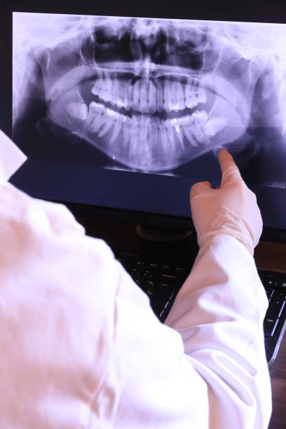 Best Emergency Treatment for Dental Infections or Abscesses in Normandy, MO
